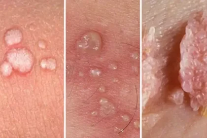 остроконечные