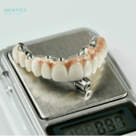 імплантацію